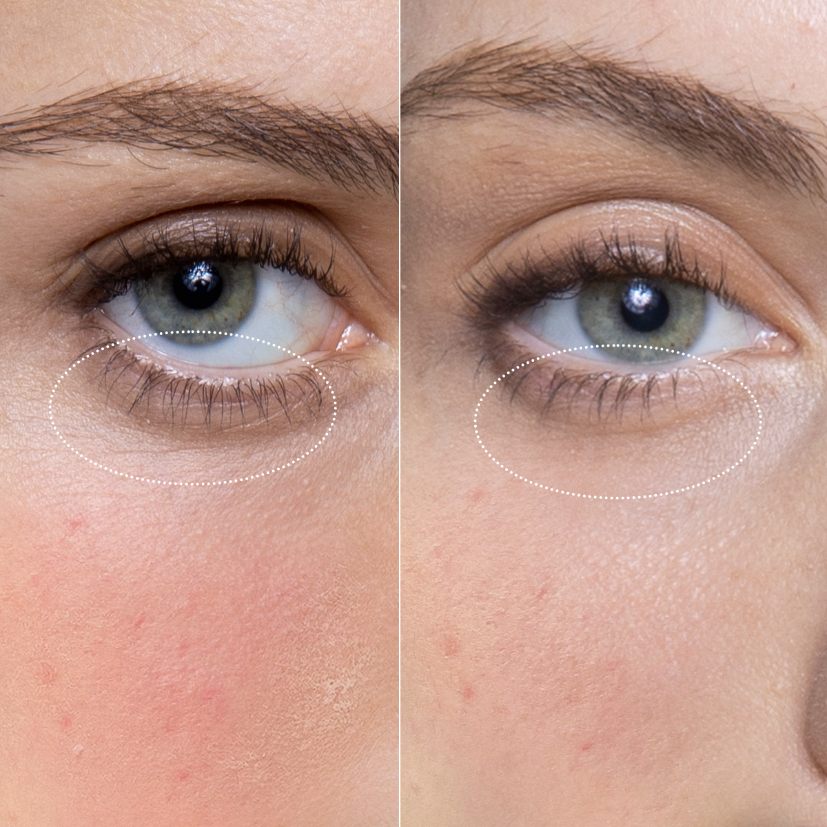 MORI-LIFT コラーゲンマスク