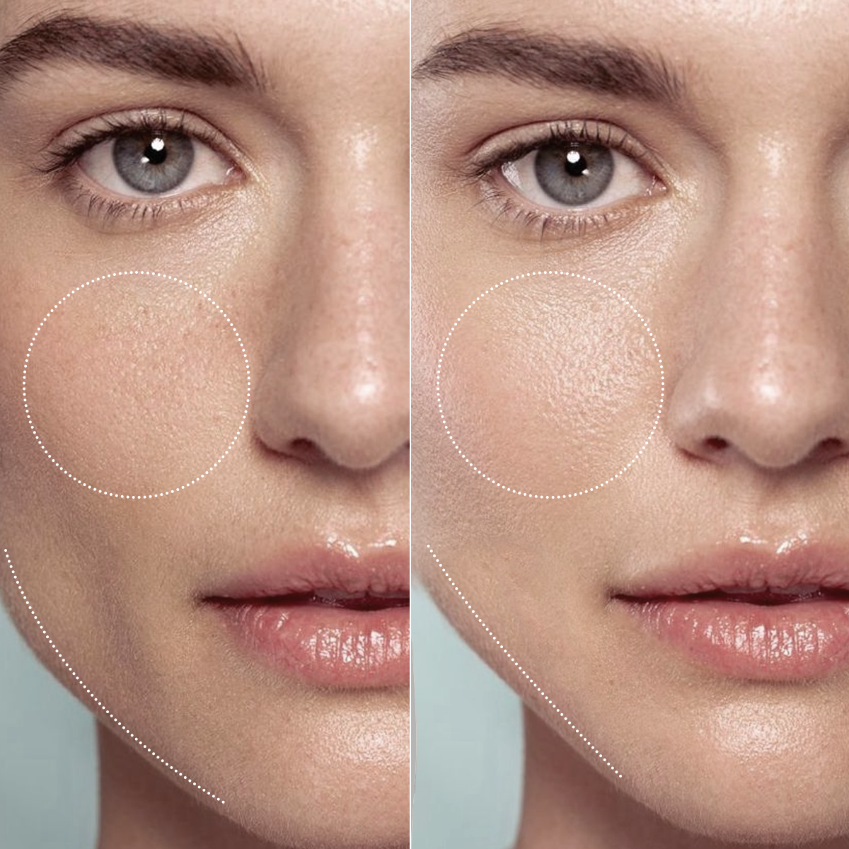 MORI-LIFT コラーゲンマスク