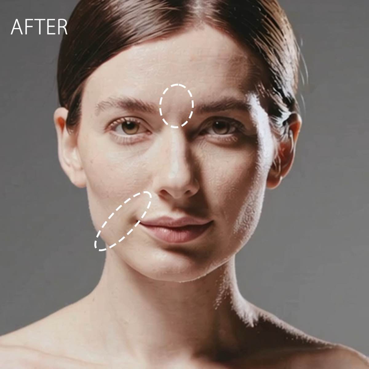 MORI-LIFT ミストスプレー