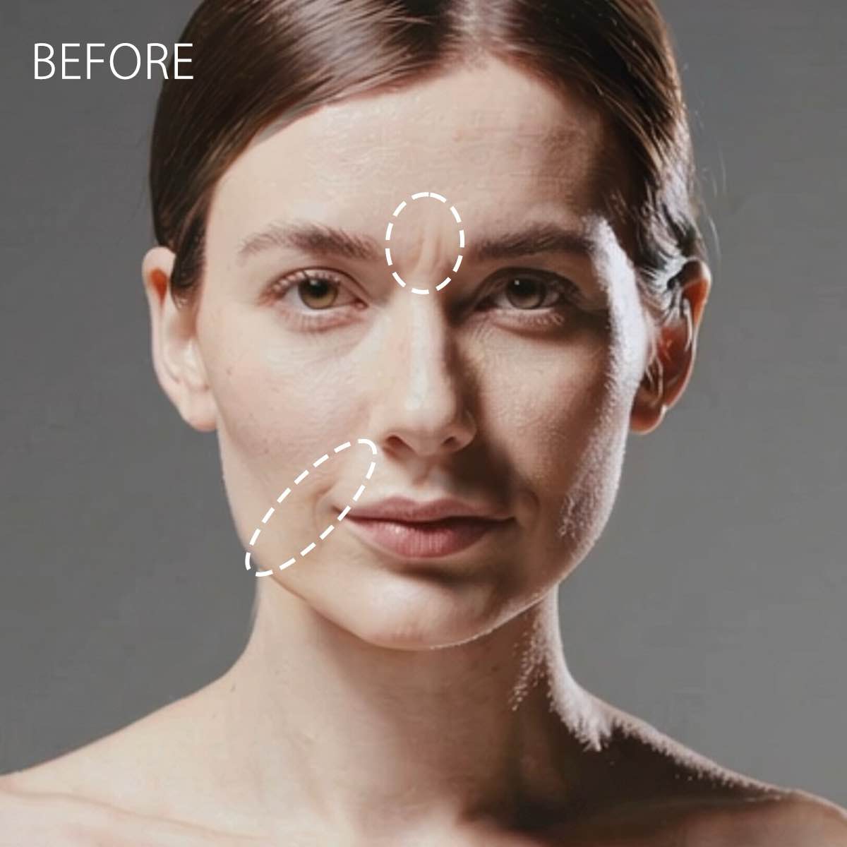 MORI-LIFT ミストスプレー